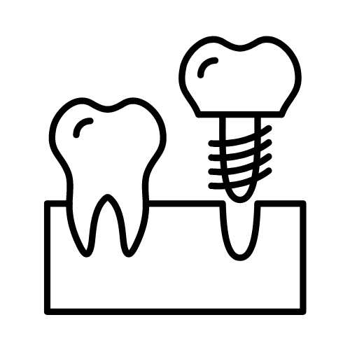 Implante Dentário em Sinop - MT
